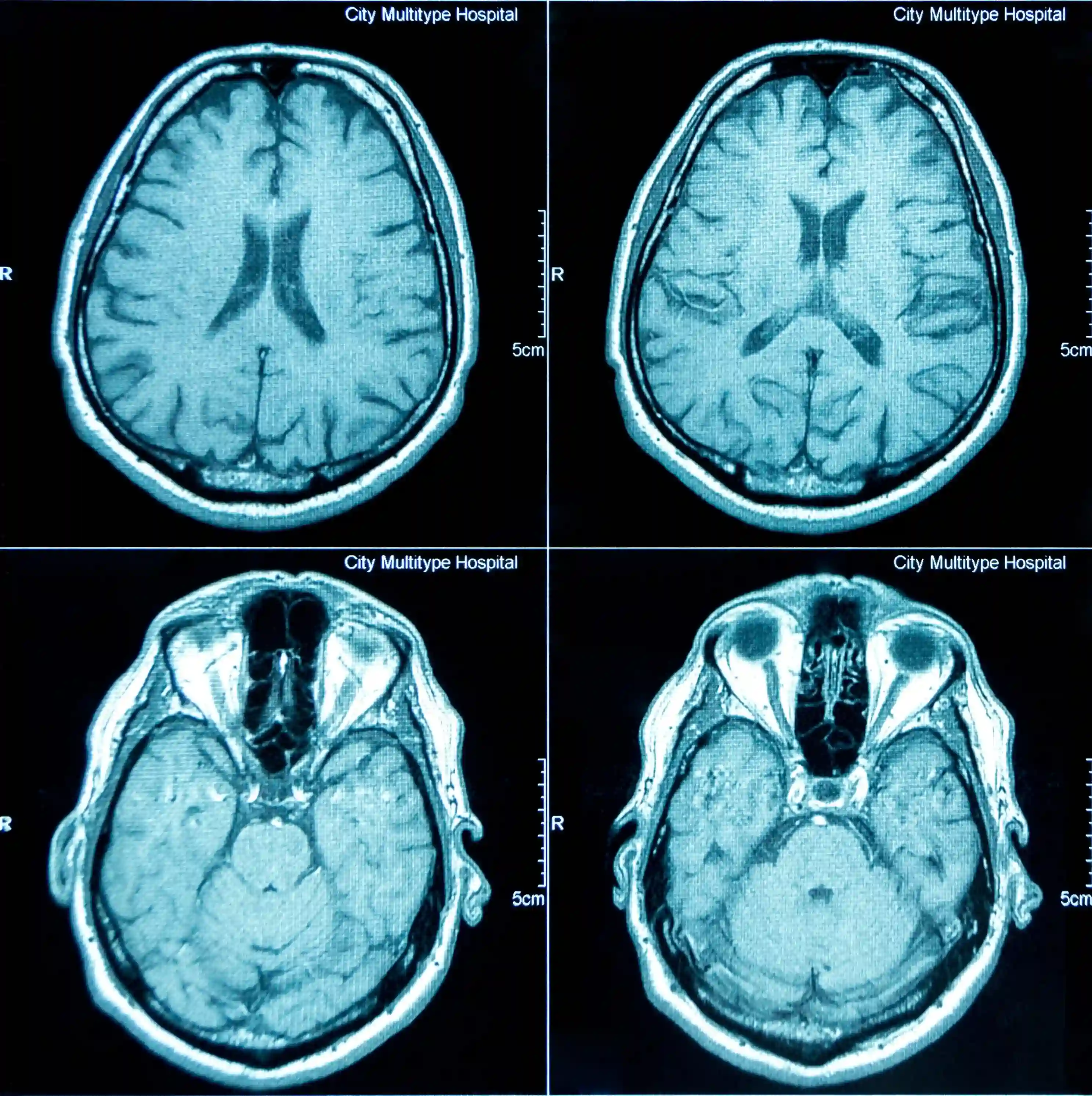 Tomografía de cerebro disponible en el portal
